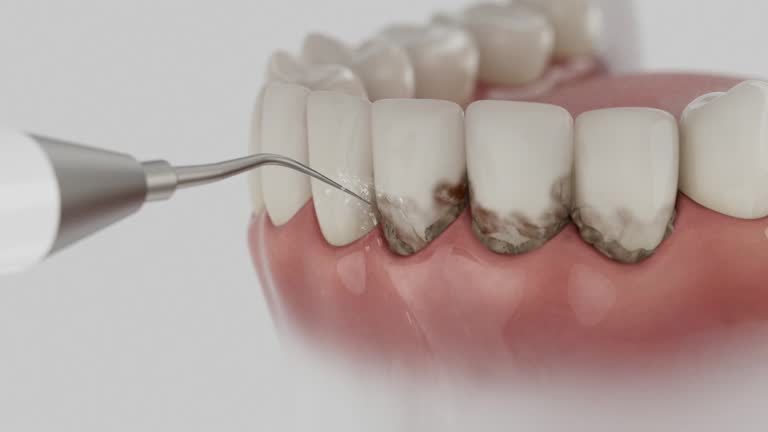 Reliable Dental contractor in St. Michael, MN by Smile Center Dentistry